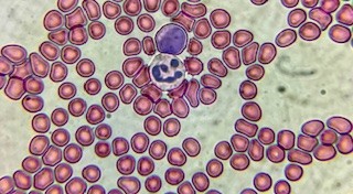 Mikroskopioari begira: Zer ezkutatzen du gure odol tanta batek?